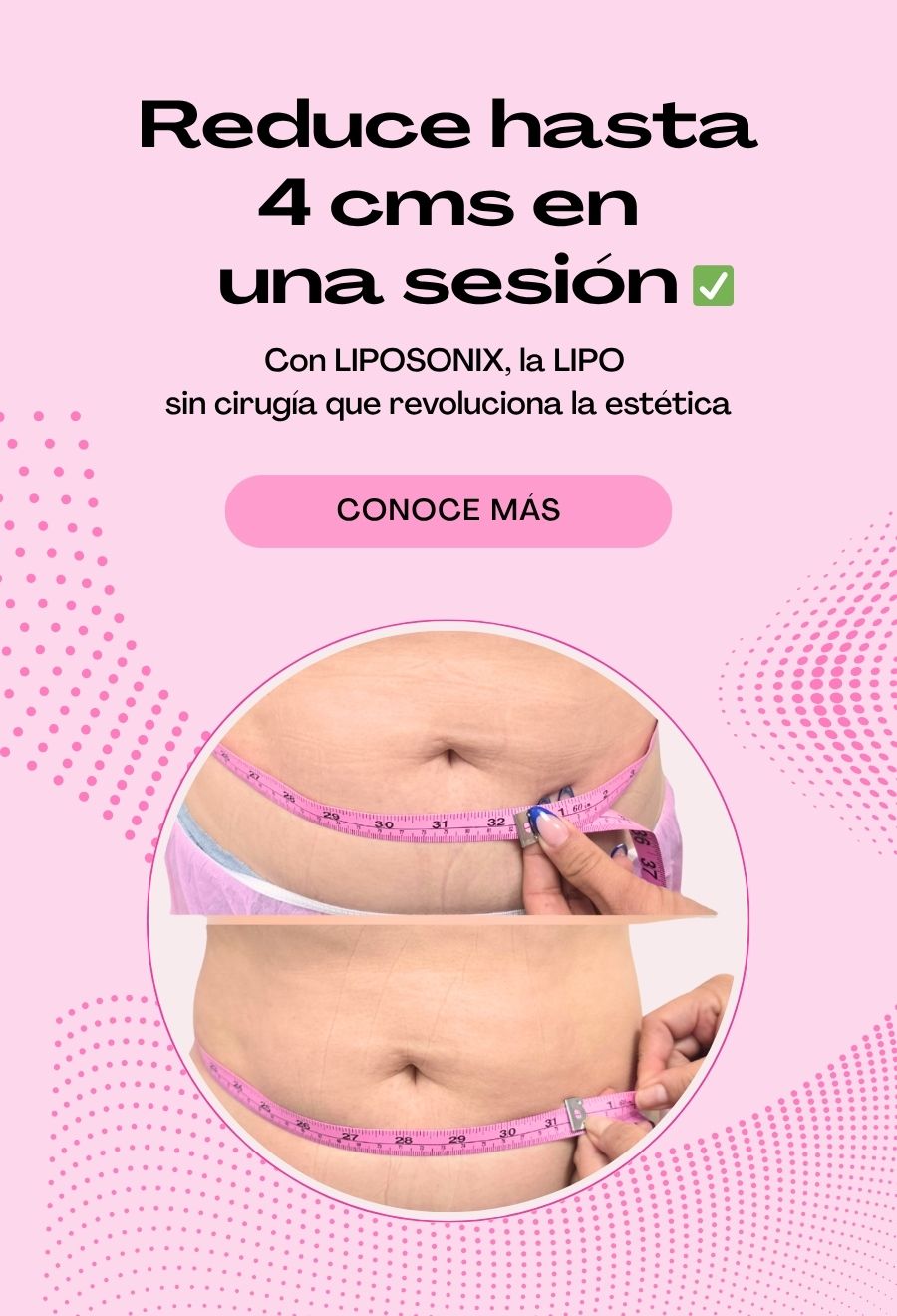 Rejuvence sin cirugias