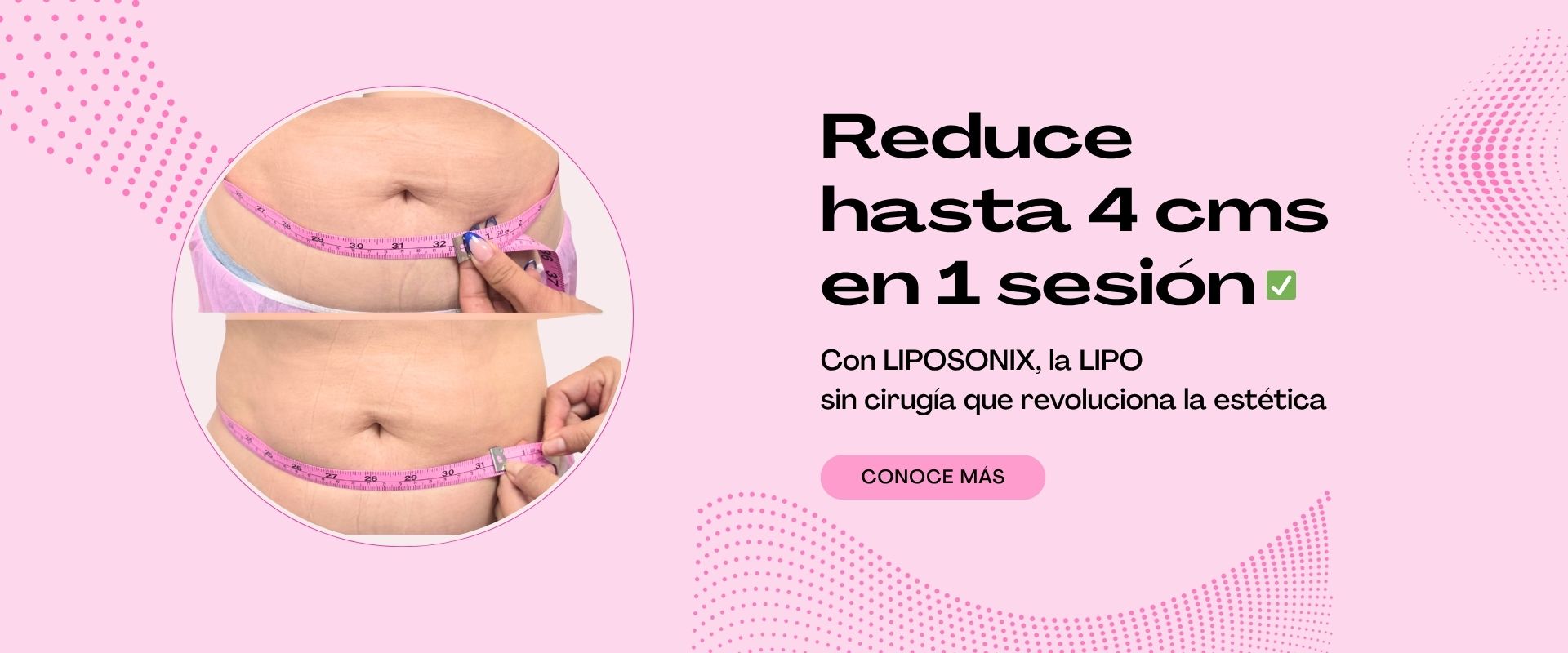 Rejuvence sin cirugias